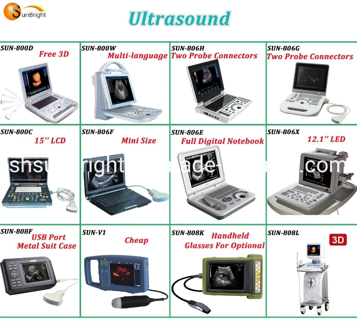 Clinic Diagnostic Cheap 4D Trolley Color Doppler Ultrasound Scanner Echo Scanner