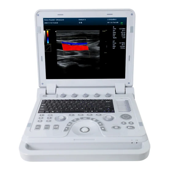 Sistema de diagnóstico por ultrasonido Doppler color para equipos hospitalarios de Contec