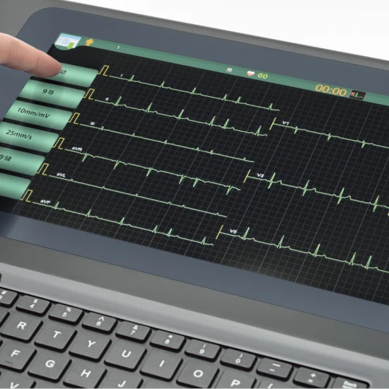 Marca Dongjiang Monitor de ECG de 12 canales Máquina de ECG digital con CE